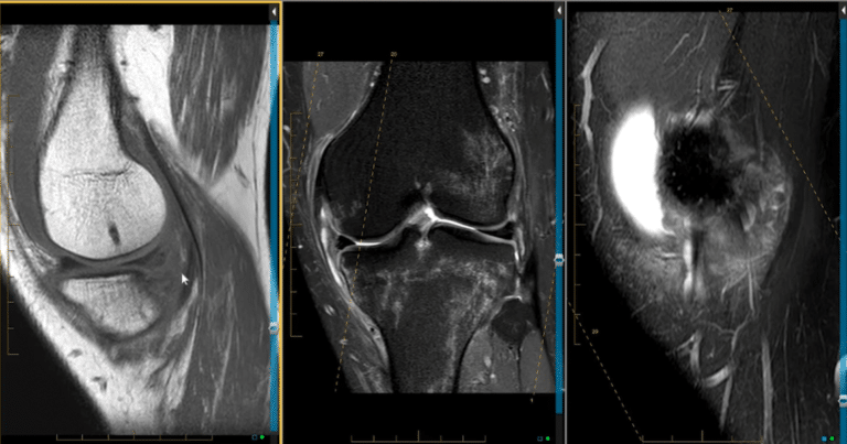 Ten Week Mri Radiology Case of the Week - MRI Online / Medality